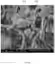 Fig. 11 - ELECTROSPUN BIOCOMPATIBLE FIBER COMPOSITIONS