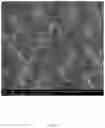 Fig. 14 - ELECTROSPUN BIOCOMPATIBLE FIBER COMPOSITIONS