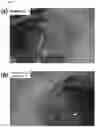 Fig. 06 - IMPLANT COMPRISING COATING LAYER FOR OPHTHALMOPATHY