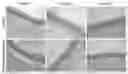 Fig. 01 - Methods and polymer compositions for treating retinal detachment and other ocular disorders
