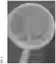 Fig. 06 - Methods and polymer compositions for treating retinal detachment and other ocular disorders