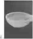 Fig. 07 - Methods and polymer compositions for treating retinal detachment and other ocular disorders