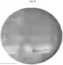 Fig. 09 - Methods and polymer compositions for treating retinal detachment and other ocular disorders
