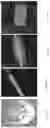 Fig. 05 - 3D-PRINTED BIORESORBABLE ALL-POLYMER COMPOSITE SOFT TISSUE SCAFFOLDS