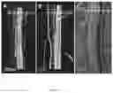 Fig. 15 - 3D-PRINTED BIORESORBABLE ALL-POLYMER COMPOSITE SOFT TISSUE SCAFFOLDS