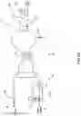 Fig. 04 - Hemodialysis systems and methods