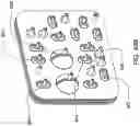 Fig. 101 - Hemodialysis systems and methods