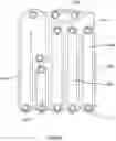 Fig. 123 - Hemodialysis systems and methods