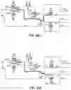 Fig. 38 - Hemodialysis systems and methods
