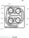 Fig. 68 - Hemodialysis systems and methods
