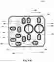 Fig. 96 - Hemodialysis systems and methods