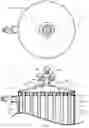 Fig. 05 - Dialyzer and dialysis apparatus