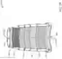 Fig. 28 - Preserving sorbent devices in dialysis systems