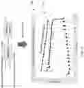 Fig. 11 - INTRAPERITONEAL PRESSURE (