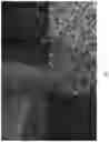 Fig. 04 - Biological fluid purification with biocompatible membranes