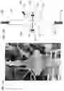 Fig. 12 - Biological fluid purification with biocompatible membranes