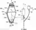 Fig. 01 - CONVERGENT-DIVERGENT DRIP CHAMBER INTEGRATED WITH FLOATING VALVE MEMBER