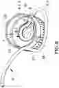 Fig. 10 - Feeding cap, drive head, and drive system