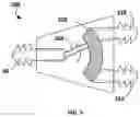 Fig. 05 - IMPLANTABLE MEDICAL DEVICE FOR CONTROLED FLUID FLOW DISTRIBUTION BETWEEN A PLURALITY OF TREATMENT CATHETERS