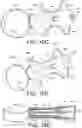 Fig. 16 - Injection delivery device