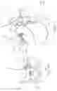 Fig. 11 - Testing Device and Method for Testing Moving Force of a Plunger of a Syringe
