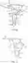 Fig. 20 - MEDICATION DELIVERY DEVICE WITH SENSING SYSTEM