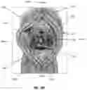 Fig. 03 - Injection device