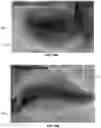 Fig. 27 - Injection device
