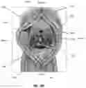 Fig. 03 - Injection device