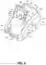 Fig. 09 - Patient attachment detection in respiratory flow therapy systems
