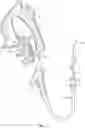 Fig. 02 - CAPTIVATION CATHETERS AND RELATED METHODS