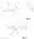 Fig. 03 - CATHETER WITH A BALLOON AND A SEPARATE INFLATION LUMEN