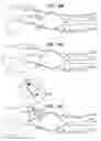 Fig. 09 - BALLOON-EQUIPPED ENDOSCOPIC DEVICES AND METHODS THEREOF