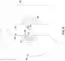 Fig. 06 - Tools for pacemaker lead implantation