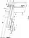 Fig. 07 - Tools for pacemaker lead implantation