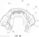 Fig. 09 - Implantable electrodes with remote power delivery for treating sleep apnea, and associated systems and methods