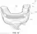 Fig. 10 - Implantable electrodes with remote power delivery for treating sleep apnea, and associated systems and methods