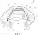 Fig. 11 - Implantable electrodes with remote power delivery for treating sleep apnea, and associated systems and methods