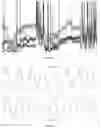 Fig. 06 - Sensors and methods for determining respiration