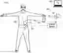 Fig. 01 - Computer-assisted pain mapping and neuromodulation system