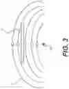 Fig. 06 - Systems and methods for magnetic field localization of charged particle beam end point