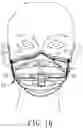 Fig. 10 - MULTIFUNCTIONAL PROTECTIVE MASK WITH SUCKING AND WHISTLING