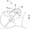 Fig. 10 - Interchangeable Filter Facemask Apparatus