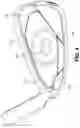Fig. 04 - Golf club head with undercut and insert