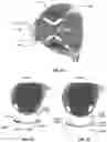 Fig. 29 - GOLF CLUB HEAD WITH IMPROVED INERTIA PERFORMANCE