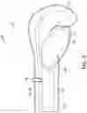 Fig. 12 - Exercise glove