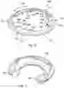 Fig. 09 - Treatment device for treating fluids, in particular liquid fluids, and treatment unit and connection head for a treatment device