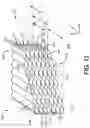 Fig. 15 - Particle separator filter with an axially extending flow face