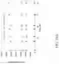 Fig. 17 - LITHIUM EXTRACTION COMPOSITE FOR RECOVERY OF LITHIUM FROM BRINES, AND PROCESS OF USING SAID COMPOSITION