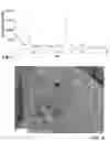 Fig. 05 - Mel-Type Zeolite for Converting Aromatic Hydrocarbons, Process for Making and Catalytic Composition Comprising Said Zeolite